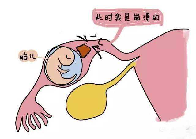 天津卵巢早衰供卵机构，天津私立试管婴儿供卵生子医院排名